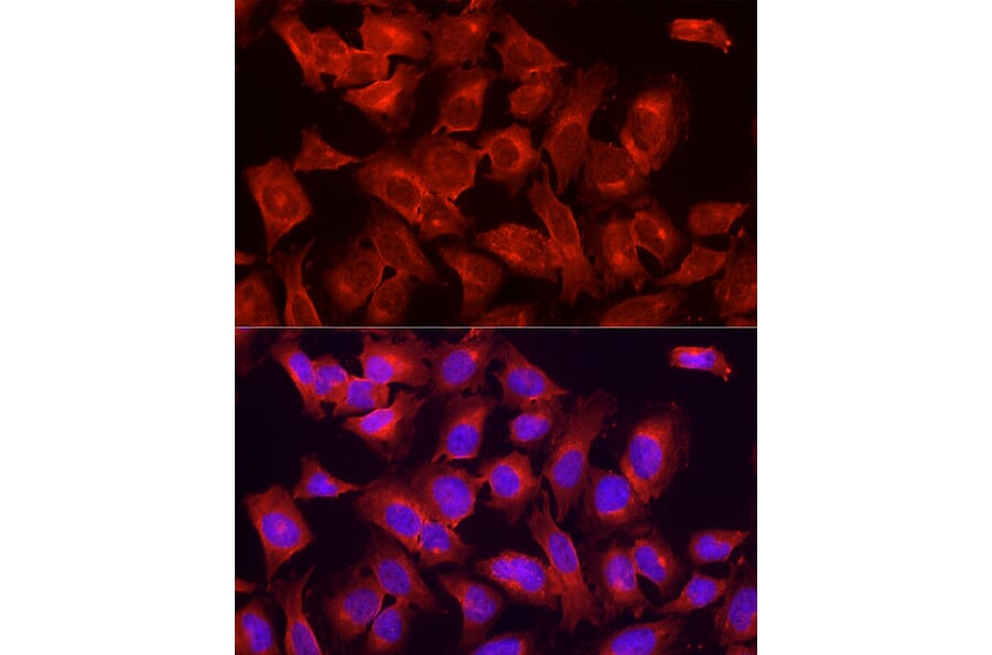 Immunofluorescence - Anti-ULK1 Antibody (A10448) - Antibodies.com