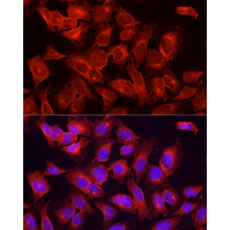 Immunofluorescence - Anti-ULK1 Antibody (A10448) - Antibodies.com