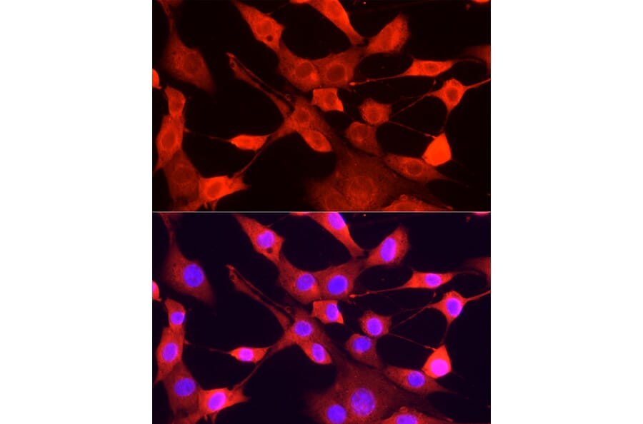 Immunofluorescence - Anti-ULK1 Antibody (A10448) - Antibodies.com