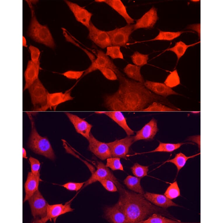 Immunofluorescence - Anti-ULK1 Antibody (A10448) - Antibodies.com