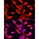 Immunofluorescence - Anti-ULK1 Antibody (A10448) - Antibodies.com