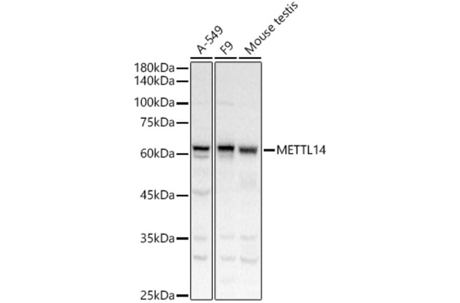 Western Blot - Anti-METTL14 Antibody (A10449) - Antibodies.com