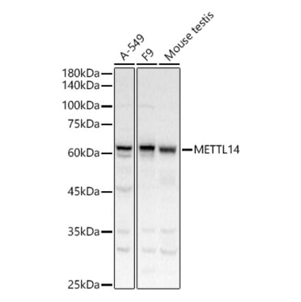 Western Blot - Anti-METTL14 Antibody (A10449) - Antibodies.com