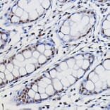 Immunohistochemistry - Anti-METTL14 Antibody (A10449) - Antibodies.com