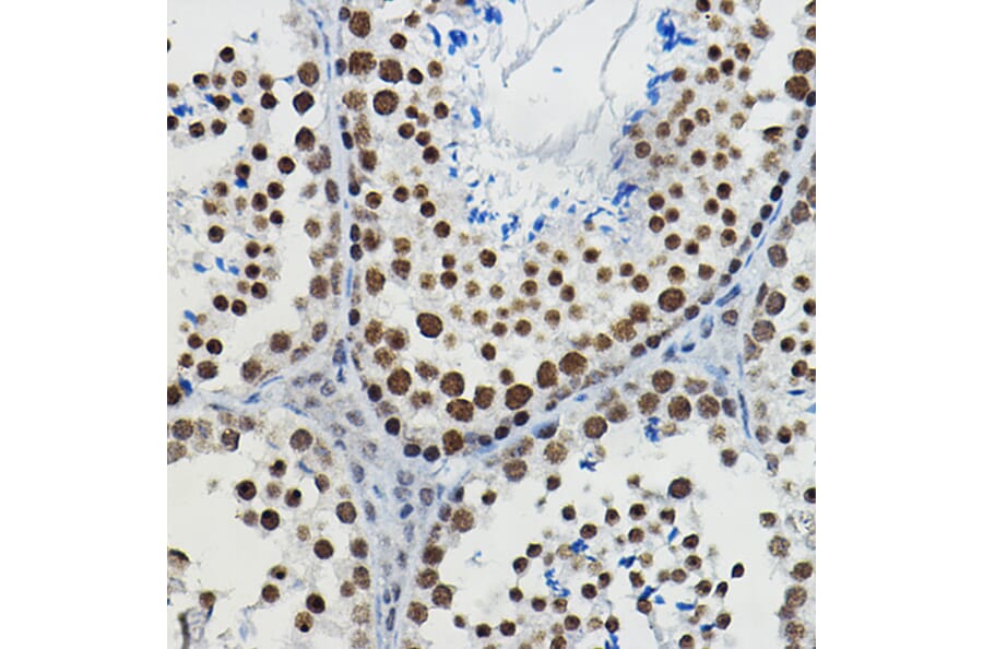 Immunohistochemistry - Anti-METTL14 Antibody (A10449) - Antibodies.com
