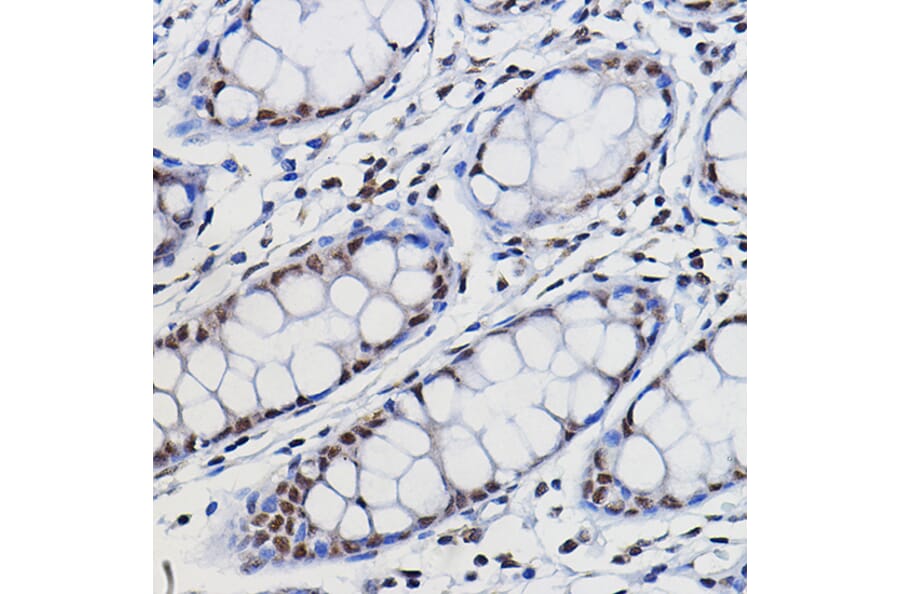 Immunohistochemistry - Anti-METTL14 Antibody (A10449) - Antibodies.com