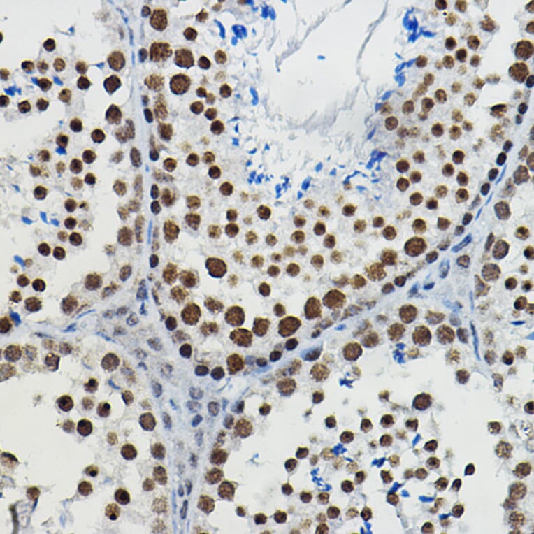 Immunohistochemistry - Anti-METTL14 Antibody (A10449) - Antibodies.com