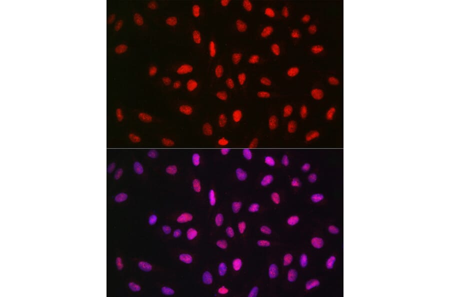 Immunofluorescence - Anti-METTL14 Antibody (A10449) - Antibodies.com