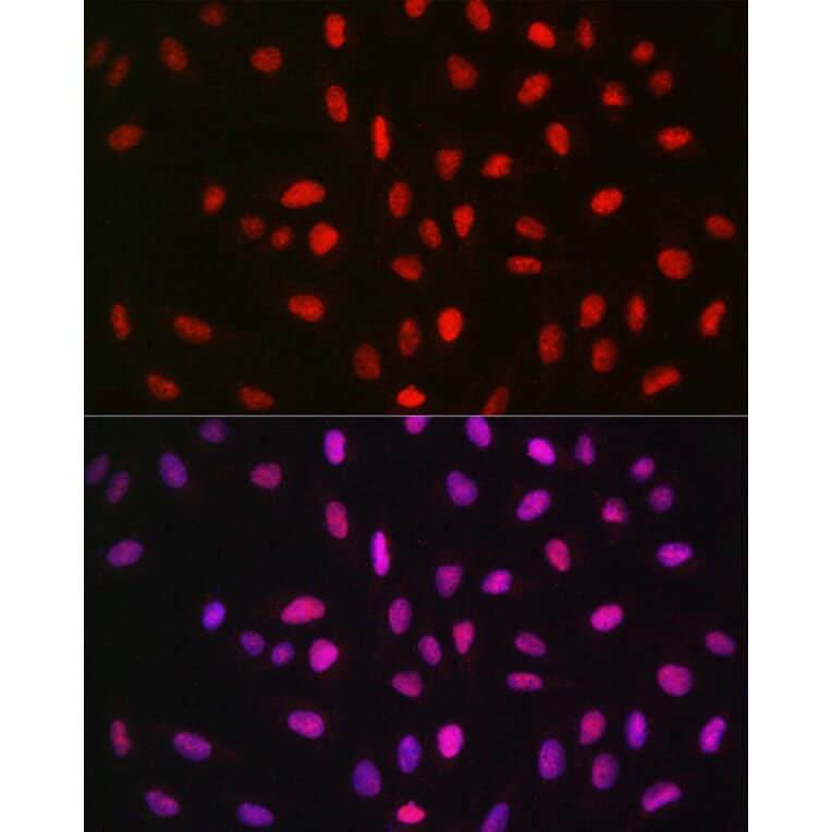 Immunofluorescence - Anti-METTL14 Antibody (A10449) - Antibodies.com