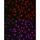 Immunofluorescence - Anti-METTL14 Antibody (A10449) - Antibodies.com