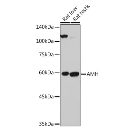 Western Blot - Anti-AMH Antibody (A10451) - Antibodies.com