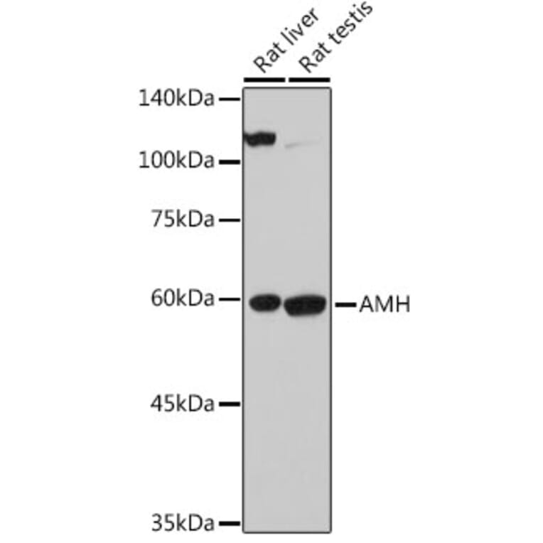 Western Blot - Anti-AMH Antibody (A10451) - Antibodies.com