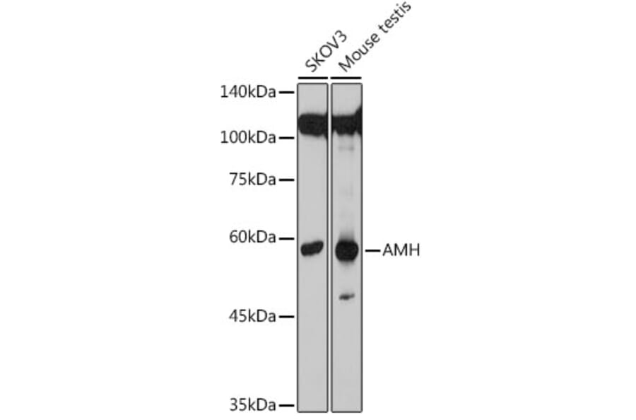 Western Blot - Anti-AMH Antibody (A10451) - Antibodies.com