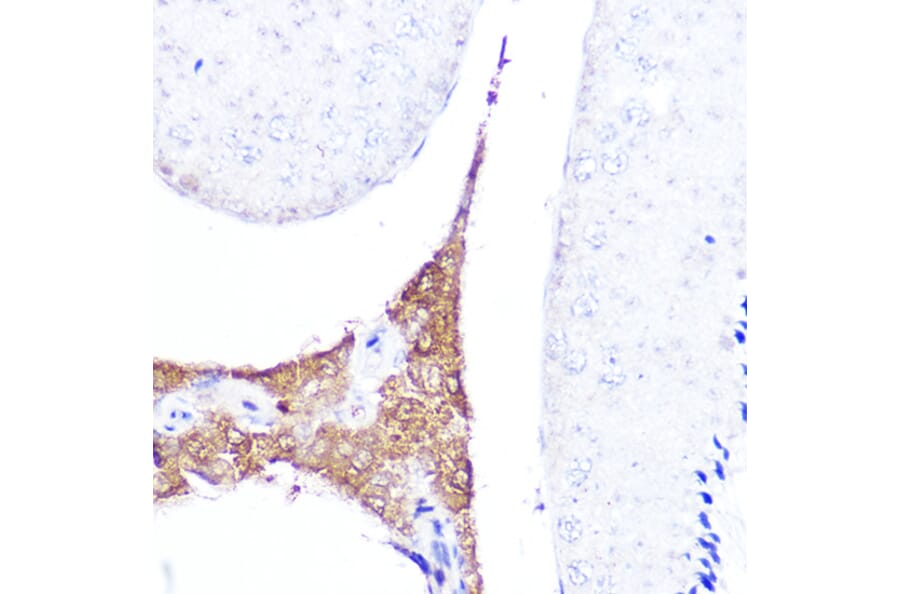Immunohistochemistry - Anti-AMH Antibody (A10451) - Antibodies.com