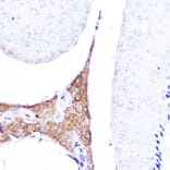 Immunohistochemistry - Anti-AMH Antibody (A10451) - Antibodies.com