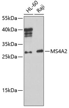 Western blot analysis of extracts of various cell lines, using Anti-MS4A2 Antibody (A8543) at 1:1,000 dilution.
Secondary antibody: Goat Anti-Rabbit IgG (H+L) (HRP) (AS014) at 1:10,000 dilution.
Lysates / proteins: 25µg per lane.
Blocking buffer: 3% non-fat dry milk in TBST.
Detection: ECL Basic Kit (RM00020).
Exposure time: 90s.
