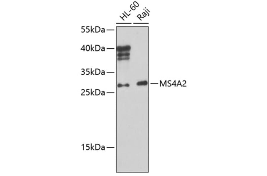 Western Blot - Anti-MS4A2 Antibody (A10452) - Antibodies.com
