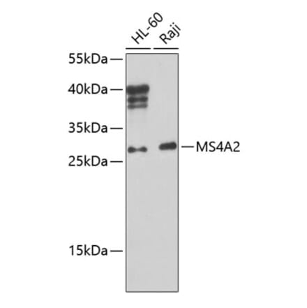 Western Blot - Anti-MS4A2 Antibody (A10452) - Antibodies.com