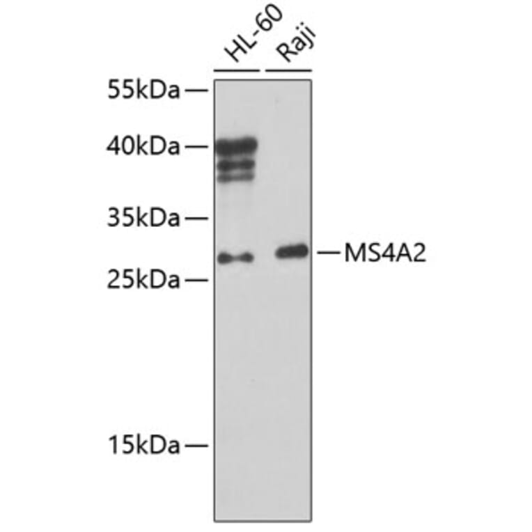 Western Blot - Anti-MS4A2 Antibody (A10452) - Antibodies.com