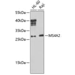 Western Blot - Anti-MS4A2 Antibody (A10452) - Antibodies.com
