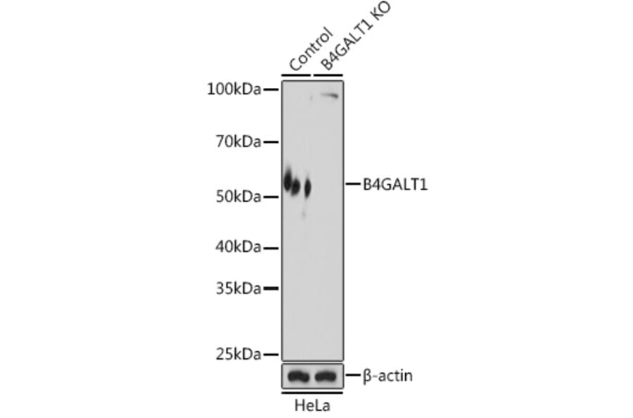 Western Blot - Anti-B4GALT1 Antibody (A10453) - Antibodies.com