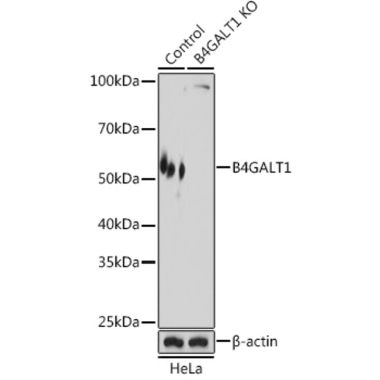 Western Blot - Anti-B4GALT1 Antibody (A10453) - Antibodies.com