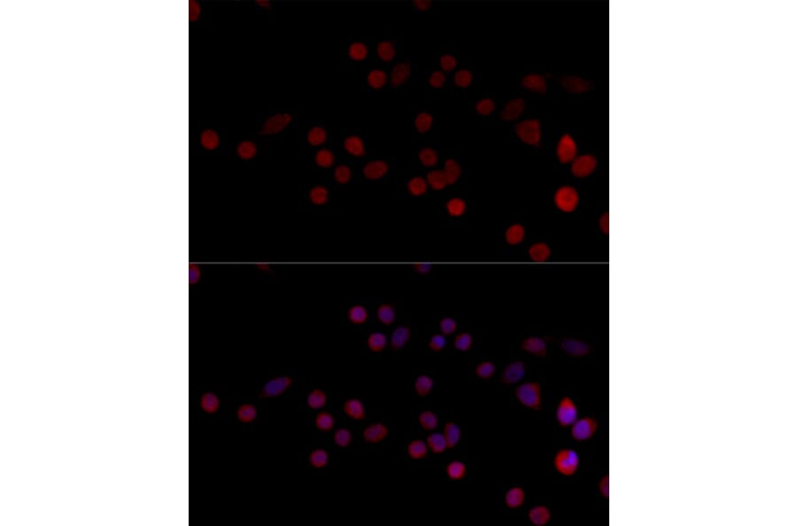 Immunofluorescence - Anti-HNRPH3 Antibody (A8549) - Antibodies.com