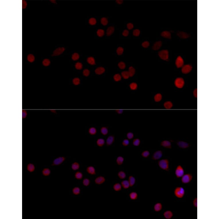 Immunofluorescence - Anti-HNRPH3 Antibody (A8549) - Antibodies.com