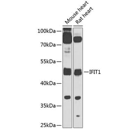 Western Blot - Anti-IFIT1 Antibody (A10456) - Antibodies.com