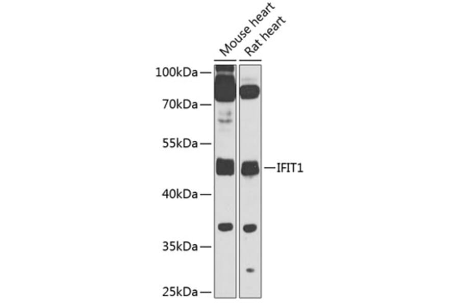 Western Blot - Anti-IFIT1 Antibody (A10456) - Antibodies.com