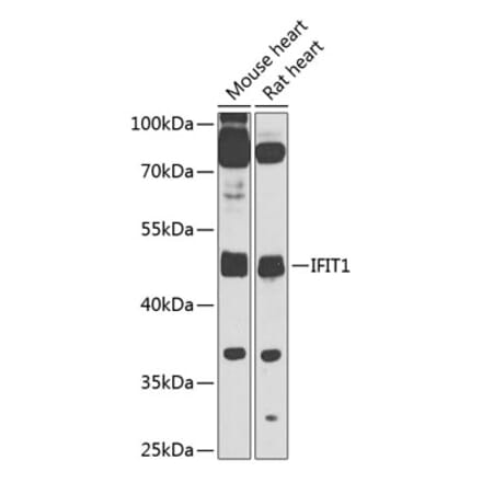 Western Blot - Anti-IFIT1 Antibody (A10456) - Antibodies.com