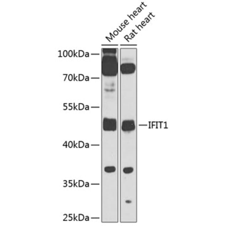 Western Blot - Anti-IFIT1 Antibody (A10456) - Antibodies.com