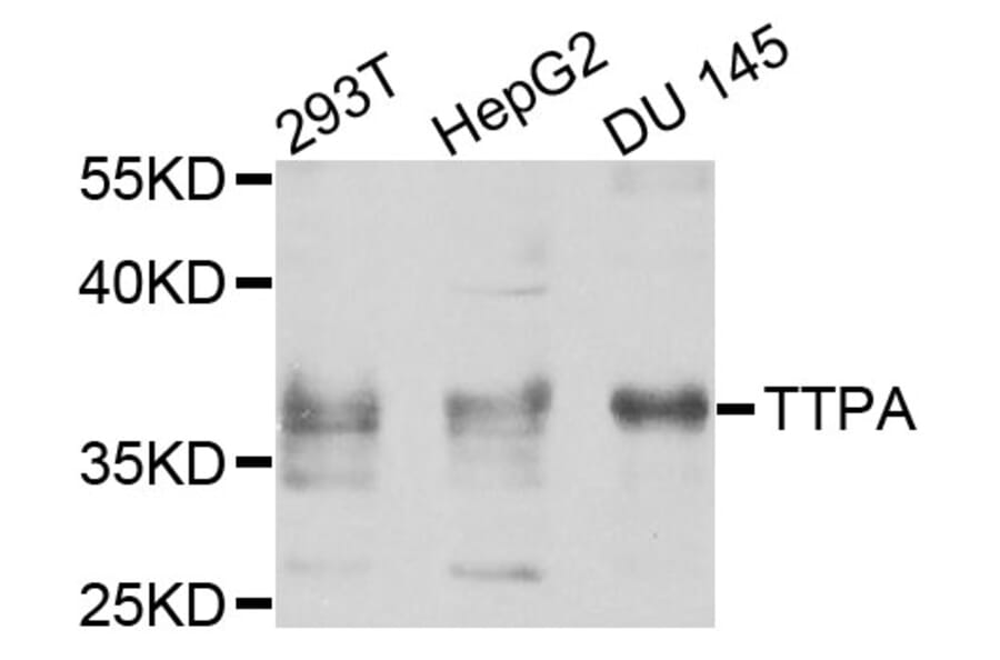 Western Blot - Anti-TTPA Antibody (A8562) - Antibodies.com