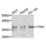 Western Blot - Anti-TTPA Antibody (A8562) - Antibodies.com