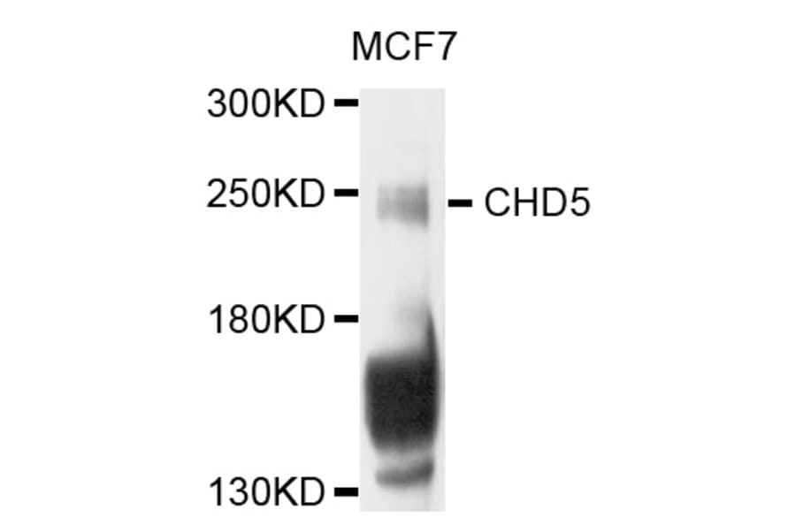 Western Blot - Anti-CHD5 Antibody (A8578) - Antibodies.com