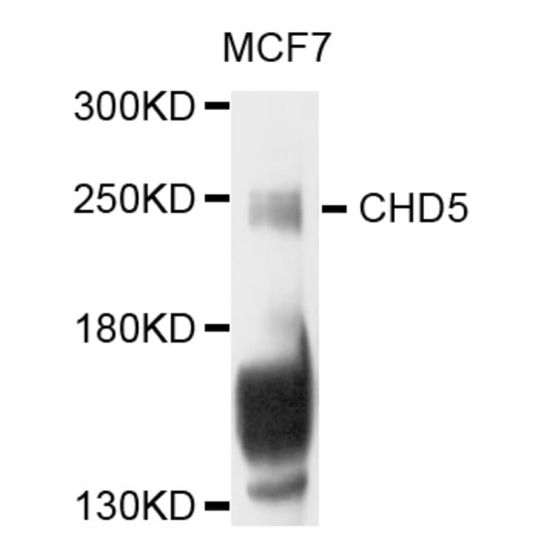 Western Blot - Anti-CHD5 Antibody (A8578) - Antibodies.com