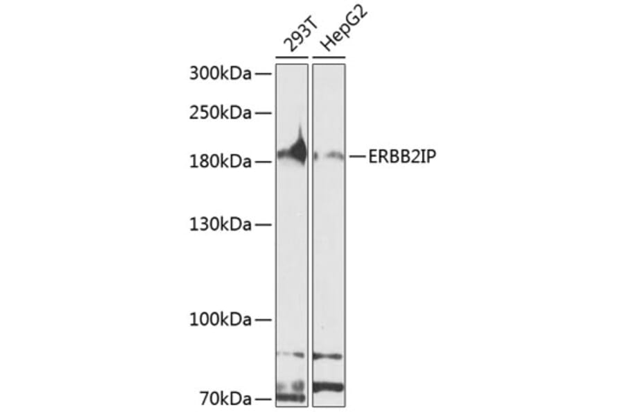 Western Blot - Anti-Erbin Antibody (A10463) - Antibodies.com