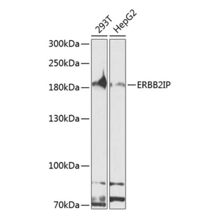 Western Blot - Anti-Erbin Antibody (A10463) - Antibodies.com