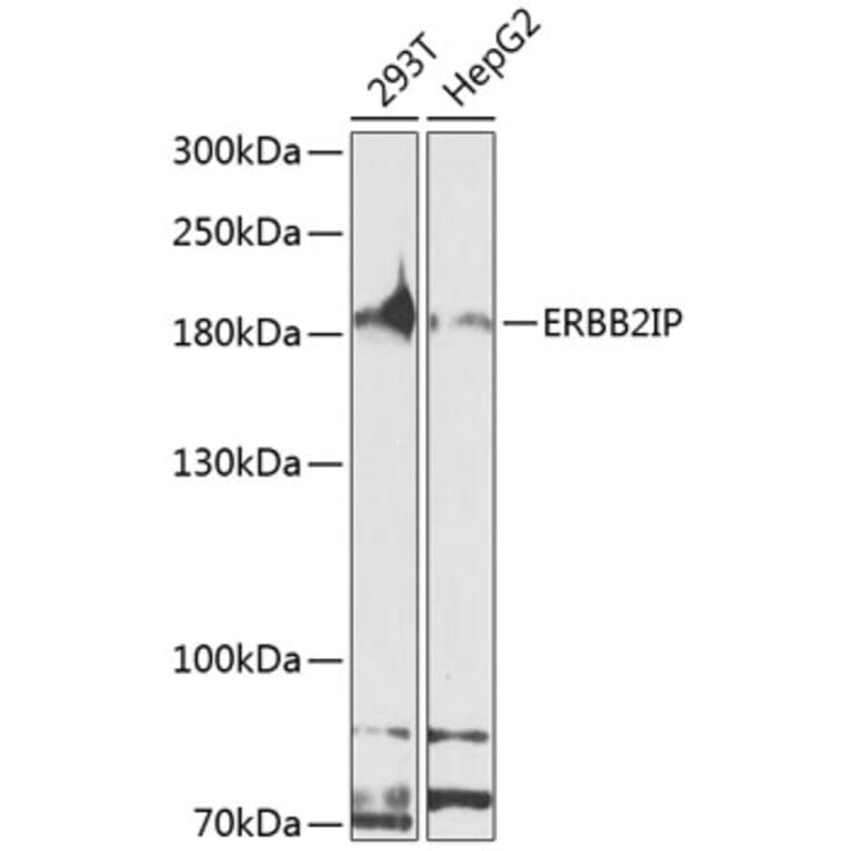 Western Blot - Anti-Erbin Antibody (A10463) - Antibodies.com
