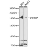 Western Blot - Anti-Erbin Antibody (A10463) - Antibodies.com