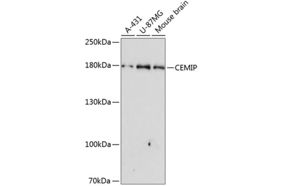 Western Blot - Anti-KIAA1199 Antibody (A10464) - Antibodies.com