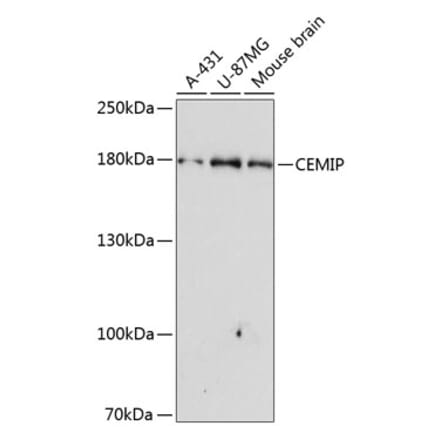 Western Blot - Anti-KIAA1199 Antibody (A10464) - Antibodies.com