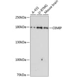Western Blot - Anti-KIAA1199 Antibody (A10464) - Antibodies.com