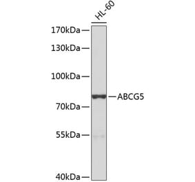 Western Blot - Anti-ABCG5 Antibody (A10465) - Antibodies.com