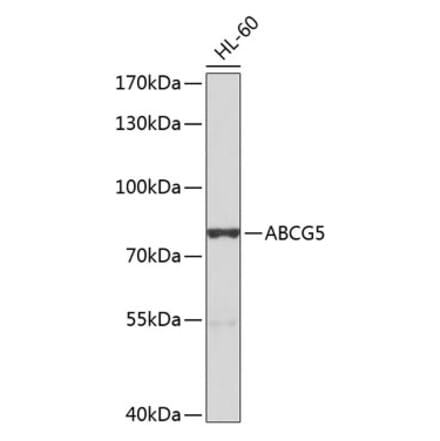 Western Blot - Anti-ABCG5 Antibody (A10465) - Antibodies.com