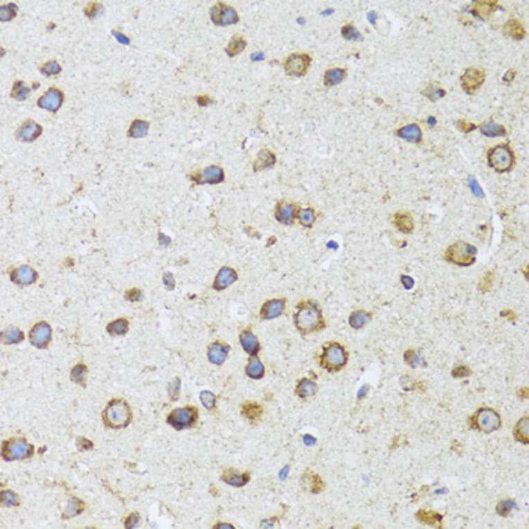Immunohistochemistry - Anti-AIFM3 Antibody (A10467) - Antibodies.com