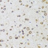 Immunohistochemistry - Anti-AIFM3 Antibody (A10467) - Antibodies.com