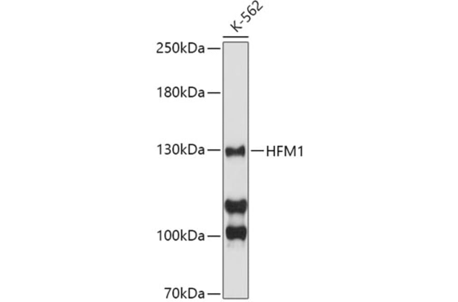 Western Blot - Anti-HFM1 Antibody (A10468) - Antibodies.com