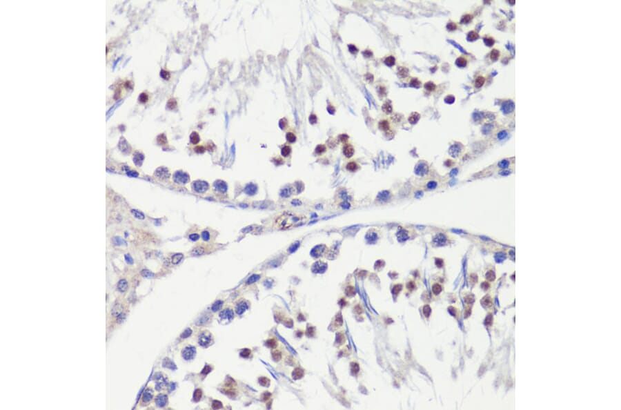 Immunohistochemistry - Anti-HFM1 Antibody (A10468) - Antibodies.com