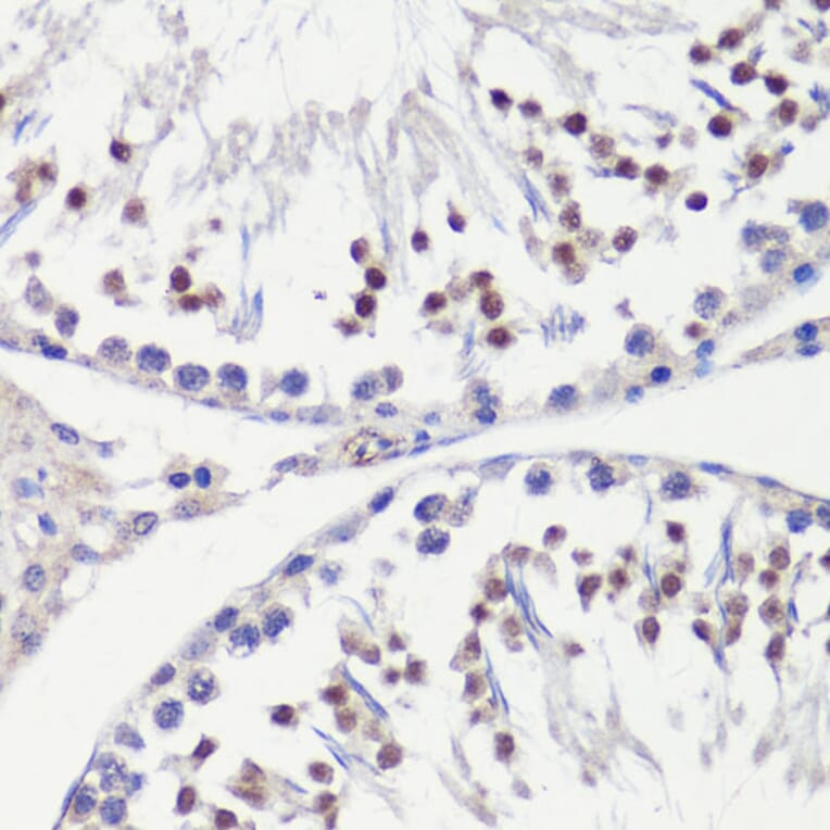 Immunohistochemistry - Anti-HFM1 Antibody (A10468) - Antibodies.com